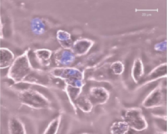 写真：（１）光治療によりがん細胞が死んで行く様子