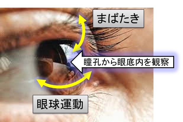 図1